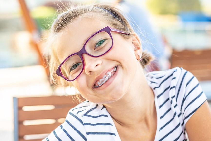 Featured image for “How Do Braces Work?”