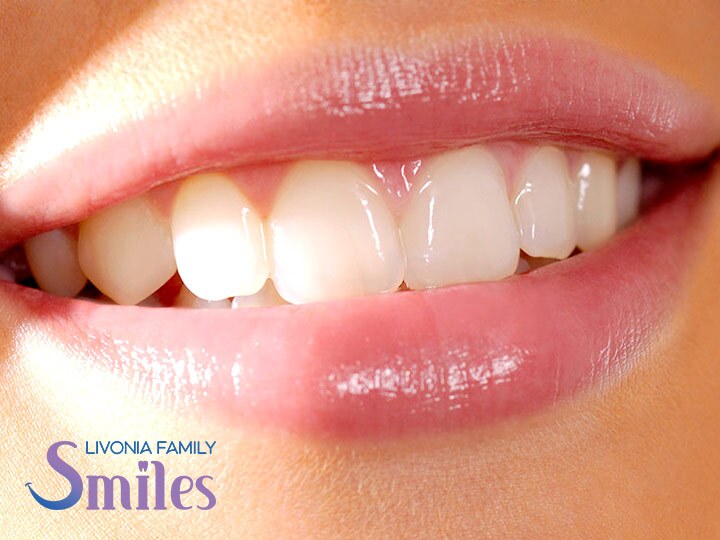 Teeth Whitening in Livonia