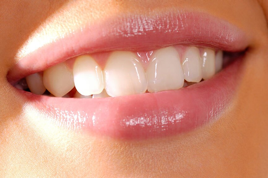 Featured image for “Achieve Your Dream Smile: Cosmetic Dentistry Solutions in Livonia”